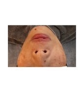 アンサー(ANSWER)/症例写真、大人女性の肌育プラン