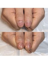 キュア(Cure.)/男性のお客様の自爪育成ジェル