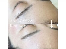 エステティック リベル キョウト 京都駅前店(Esthetic Liber Kyoto)/フェイスワックス脱毛