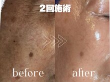 サロン ルテラ(SalonRutella)