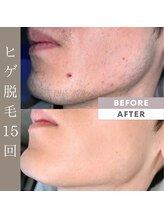 メンズラボ 京都駅前店/キャンペーン実施中！