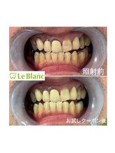 ルブラン 奈良店(Le Blanc)/男性の方も！！