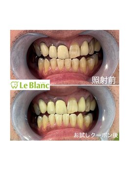 ルブラン 奈良店(Le Blanc)/男性の方も!!