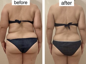 ルシエル ハカタ(Luciel HAKATA)