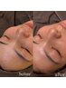 新メニュー☆眉＆facewax＆クリアグロウピール☆17,800～HBL＋1,000