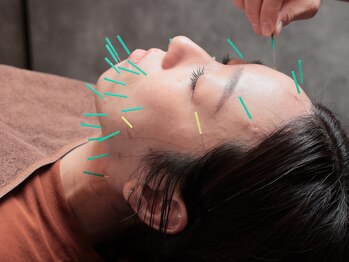 めいてる/【眠れる美容鍼】大阪市旭区