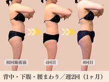 ヨサパーク ミューズ(YOSA PARK MUSE)/体の厚みが薄くなってスッキリ！