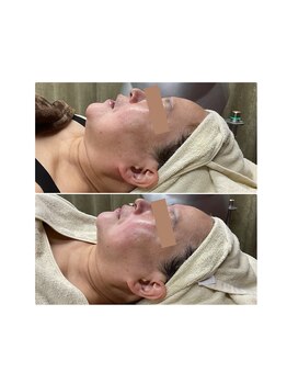 メイス 福井店(MEIS)/お客様before、after