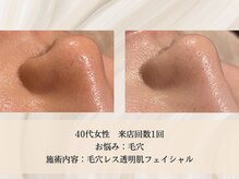 エクストリミティ 国立店(EXTREMITY)/お客様の変化