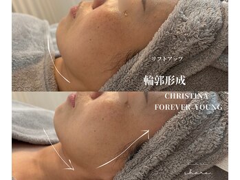 シェア(share.)/ハリ 弾力 リフトアップ！！