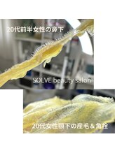 ソーヴ(SOLVE)/黒ずみ毛穴や角栓にも！角質ケア