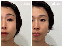 KTYフェイスジム 名古屋栄店(KTY FACE GYM)/1回のビフォーアフター♪