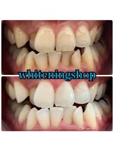 ホワイトニングショップ 越谷店/