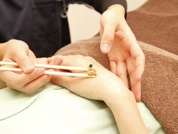 浦和のあ鍼灸整骨院/もぐさでお灸