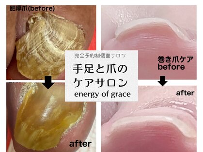 エナジー オブ グレース(energy of grace)の写真