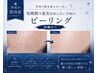 本気の肌改善★短期間で変化を出したい方向けピーリング(剥離あり)