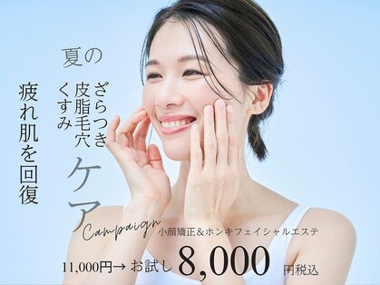 スーフラワー(SOO-flower)の写真