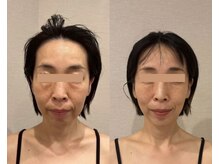 ドクターボディクリスタル(Dr.Body Crystal)の雰囲気（独自のハンド技術と最新マシンでたるみ改善）