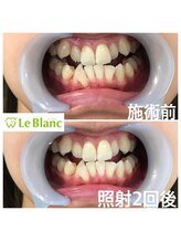 ルブラン 奈良店(Le Blanc)/白さ体感ください！！