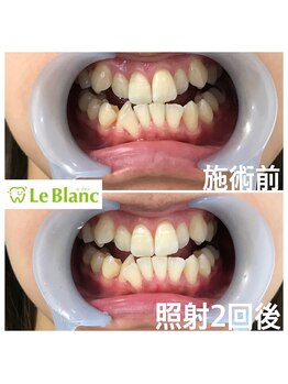 ルブラン 奈良店(Le Blanc)/白さ体感ください!!