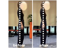 カワル整体 上通り院/肩こりがひどく吐き気ももよおす