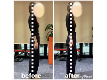 カワル整体 上通り院/肩こりがひどく吐き気ももよおす