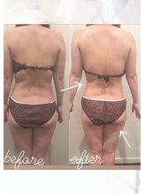 エングロー(Englow)/強圧インド式オールハンドエステ