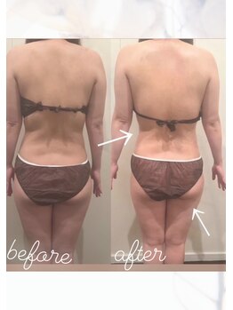 エングロー(Englow)/強圧インド式オールハンドエステ