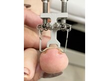 ネイルズ グラヴィス デュオ(Nails Gravis duo)