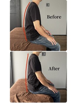 ニュートラル(NEUTRAL)/整体ビフォーアフター