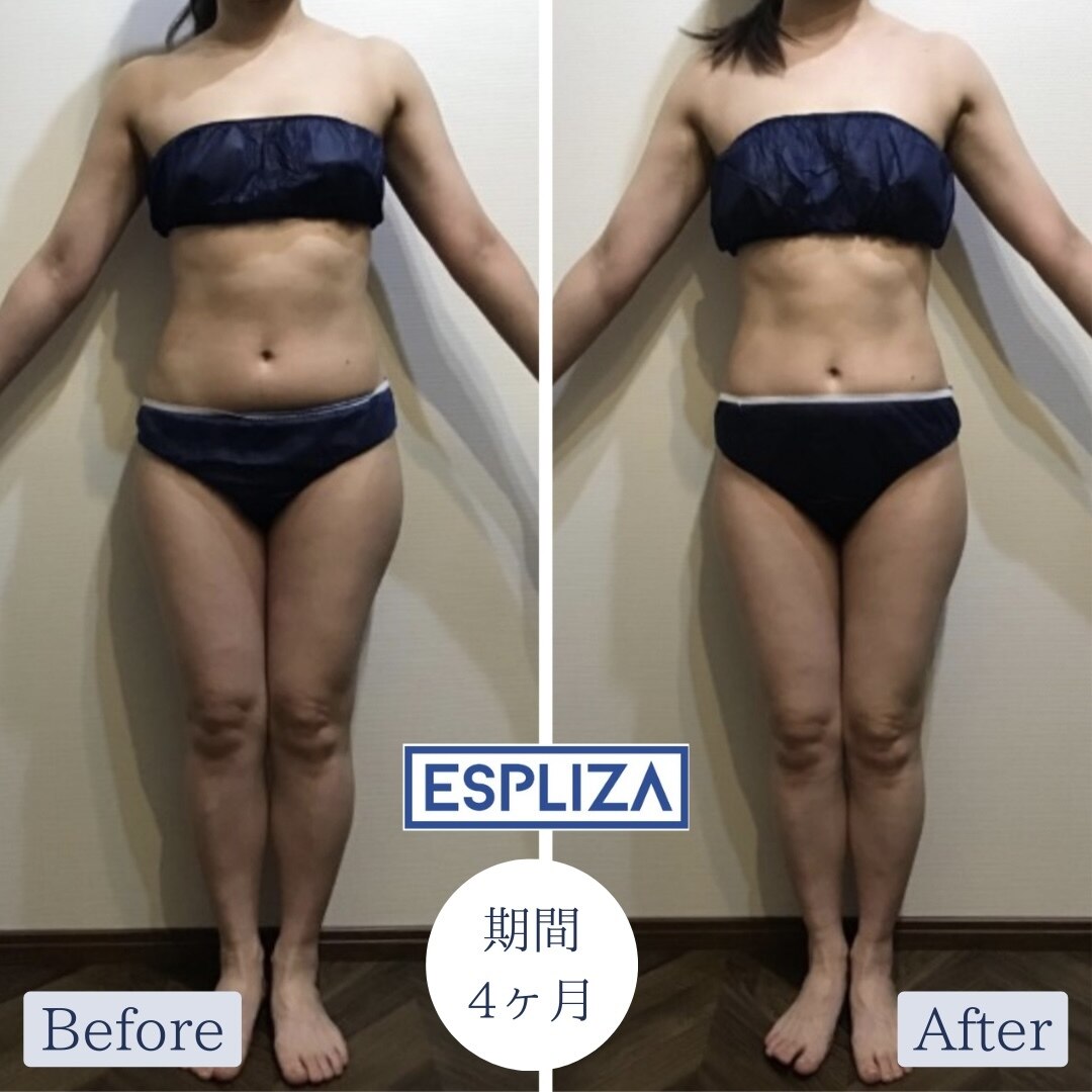 本格家庭用痩身エステ 座るだけで下半身トータルケア「スパトレーナー」｜カンタン、キレイ