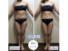 1台5役の最強痩身マシンで理想の自分イチ美ボディに！痩身エステ