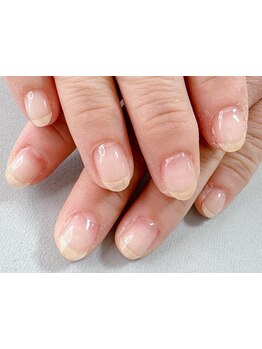 爪の悩みを解消できる（ケア含む）