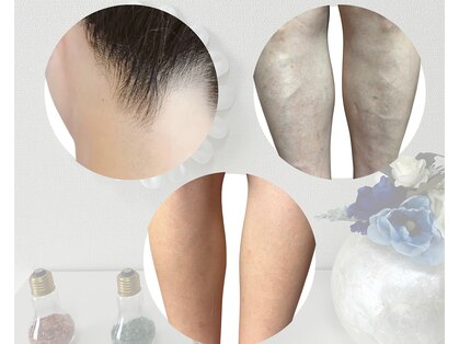 バーム(BAAM)の写真