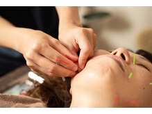 サニー(Sunny)/髪の毛よりも細い鍼です！