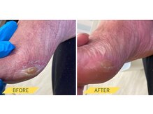 ふっとけ庵/たこケア