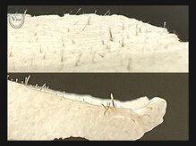 ヴィオール 名古屋栄店(VIOR)/1度で角栓産毛大量にキャッチ！