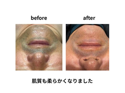 デサフィオ(Desafio.sln)の写真