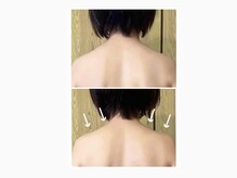エソラサロンの雰囲気（【施術１回の変化】巻き肩・猫背スッキリ◎軽さのある肩へ♪）