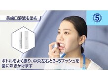 ガーディー(GaDaY)/セルフホワイトニング