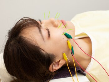 ウェルネス町田鍼灸院 整骨院(WELLNESS町田鍼灸院 整骨院)/美容鍼