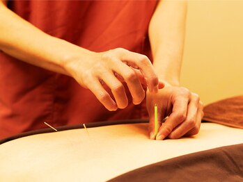 ジネコラボ 藤沢院(Gyneco-labo)の写真/女性の為の【鍼灸×整体】鍼灸15年の実績◎豊富な知識と施術歴で,毎日元気でいられるようサポート致します!