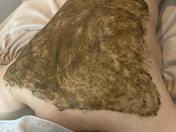 プララン(Plaran)/お背中ピーリング(剥離無し)