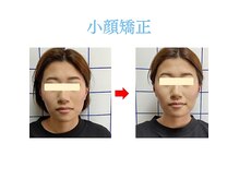 マインドボディ コモレビ(MIND BODY Komorebi)の雰囲気（【小顔矯正】一度で左右非対称を一気に改善！本人も大満足(^^♪）