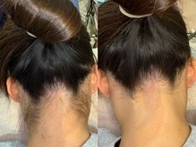 マナ(mana)の雰囲気(うなじ)