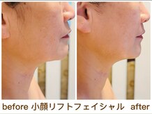 ルル リラクゼーション(RURU Relaxation)