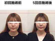 そよな はり灸整骨院の雰囲気(丁寧なカウンセリングでしっかりお悩みをお聞きします!)