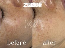 サロン ルテラ(SalonRutella)