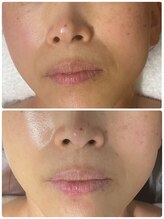 らくらく韓国エステ/フェイシャルメニュー