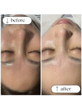 トータルビューティーサロンリア(Li'a)/ビフォー＆アフター